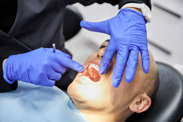 Best Urgent Care for Lost Fillings or Crowns in Des Moines, IA